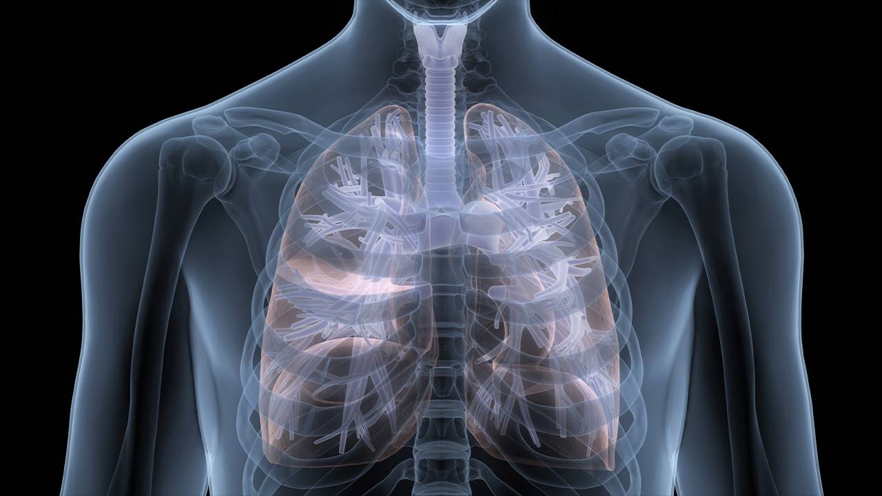 Fibrosis pulmonar