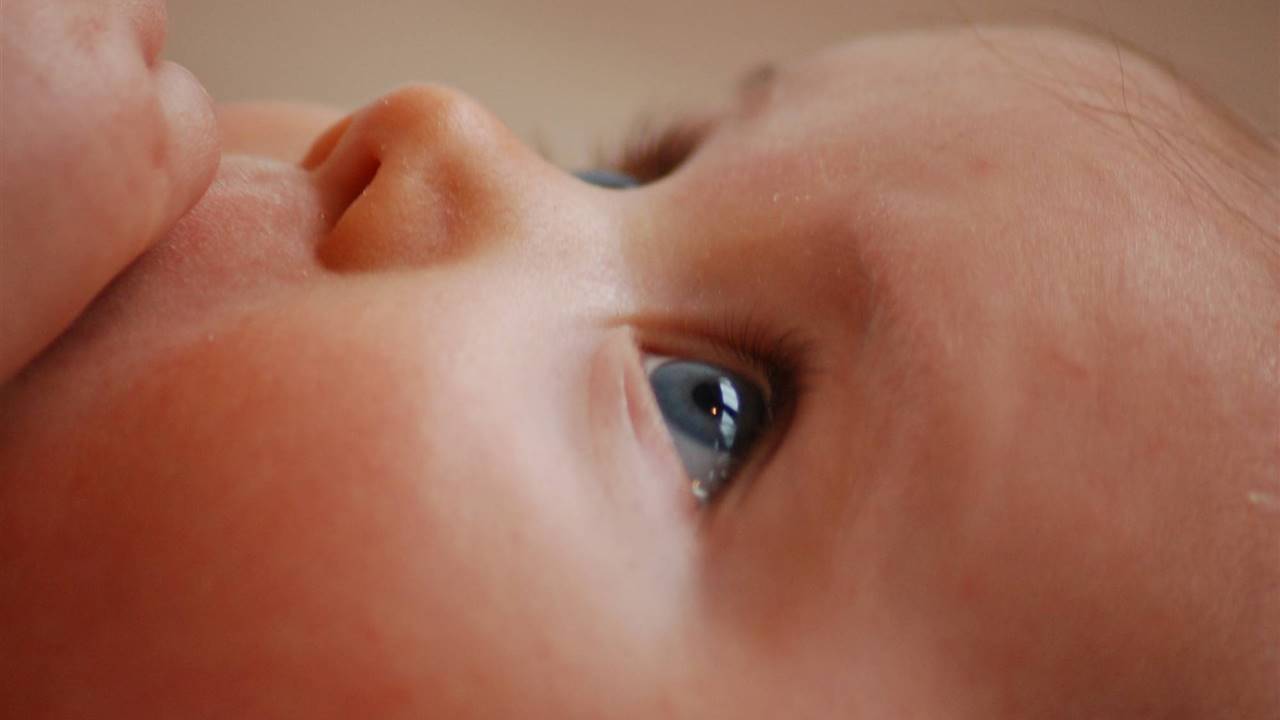 Cómo tratar la conjuntivitis en los niños