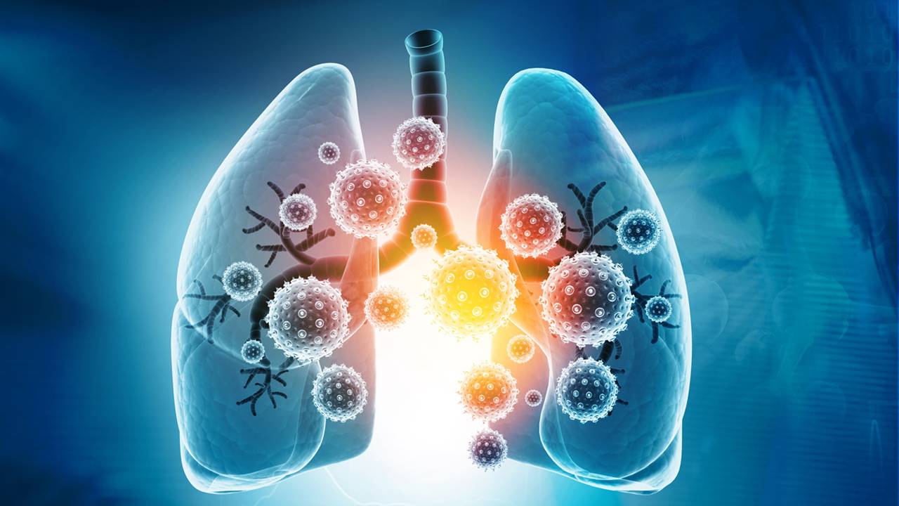 El pulmón también tiene microbioma y podría afectar al pronóstico del cáncer