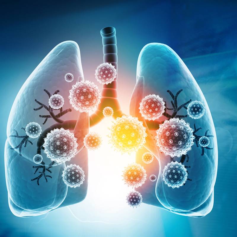 El pulmón también tiene microbioma y podría afectar al pronóstico del cáncer