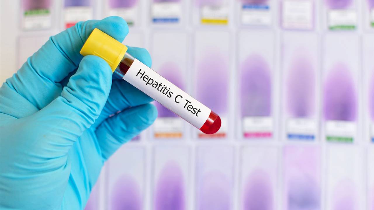 España podría eliminar la hepatitis C seis años antes del objetivo fijado por la OMS