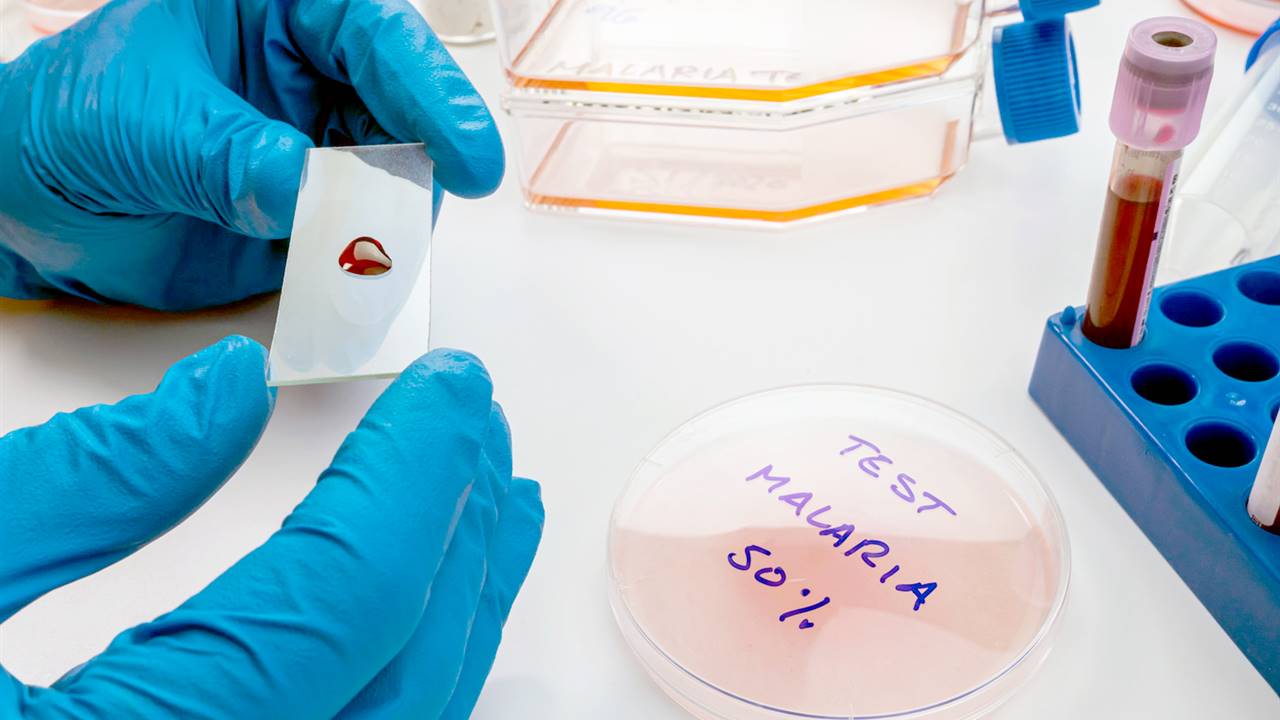 La malaria se está volviendo resistente a los medicamentos