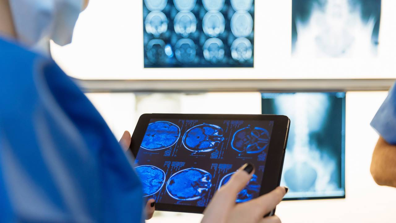 Qué es el gioblastoma 