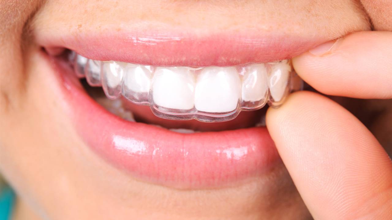 Cómo funciona la ortodoncia invisible