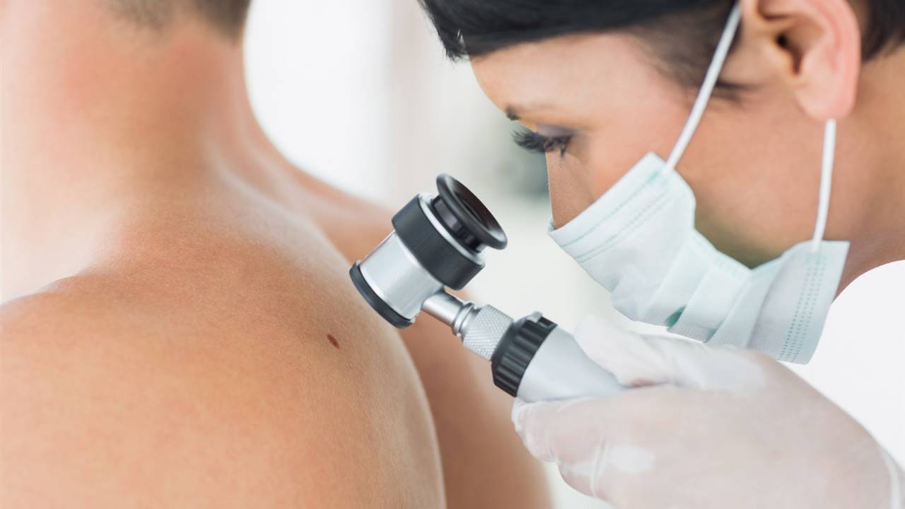 Avances en el diagnóstico y el tratamiento del cáncer de piel