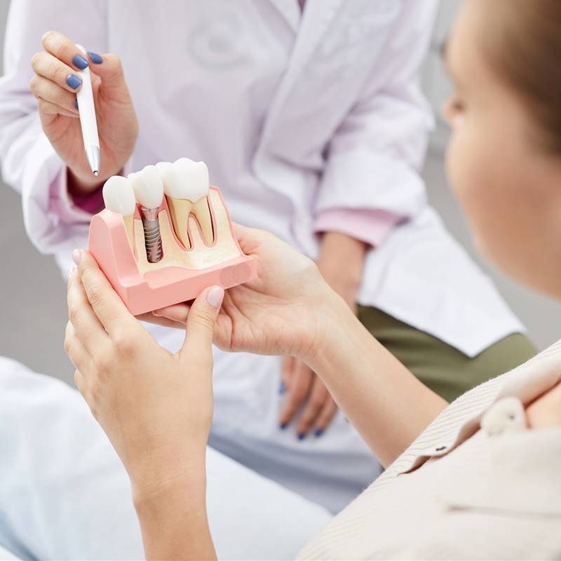 Implante dental 8 mitos 