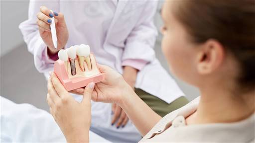 Implante dental 8 mitos 