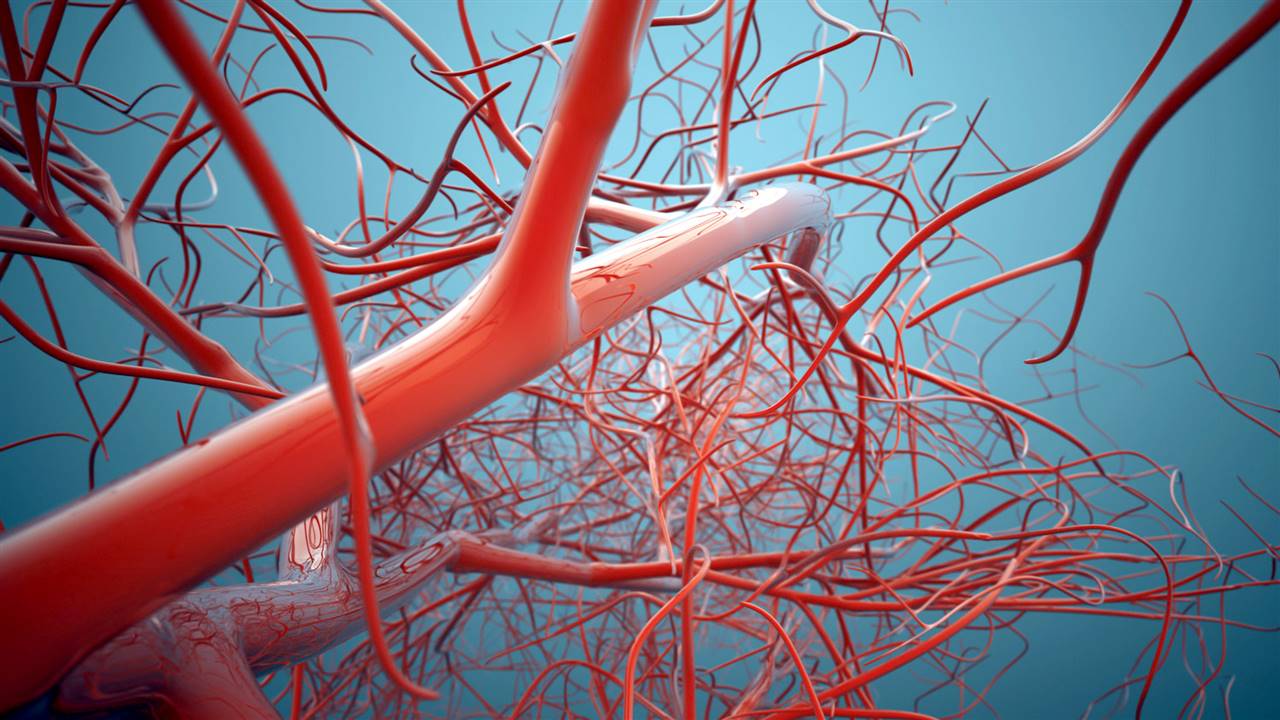 Enfermedad cerebral de los vasos sanguíneos pequeños