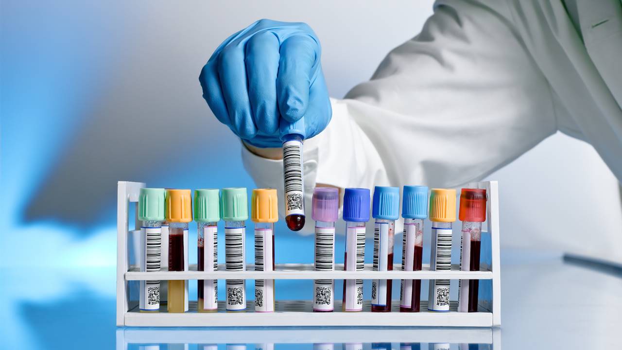 Un autotest en casa para detectar cancer de endometrio
