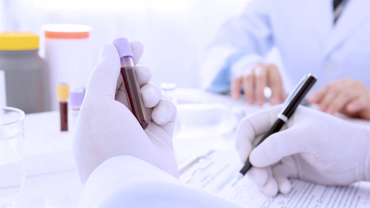 Un análisis de sangre podría detectar el cáncer 4 años antes que otras pruebas
