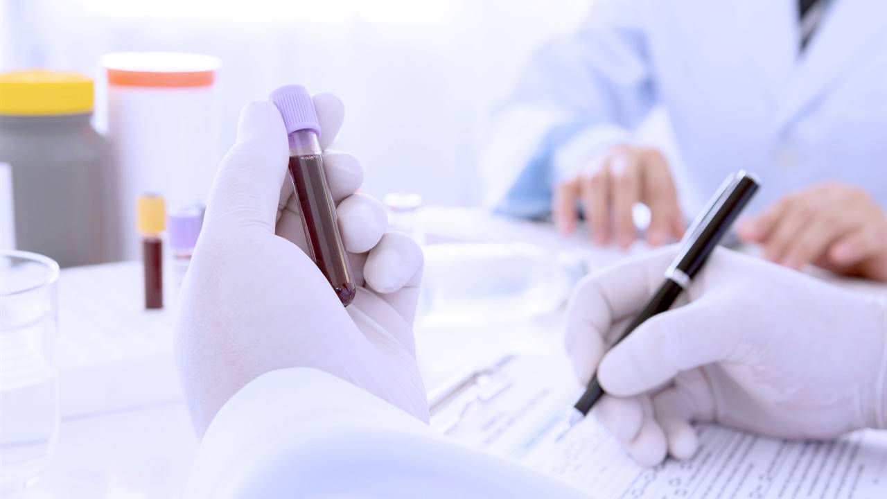 Un análisis de sangre puede detectar el cáncer antes de que provoque síntomas