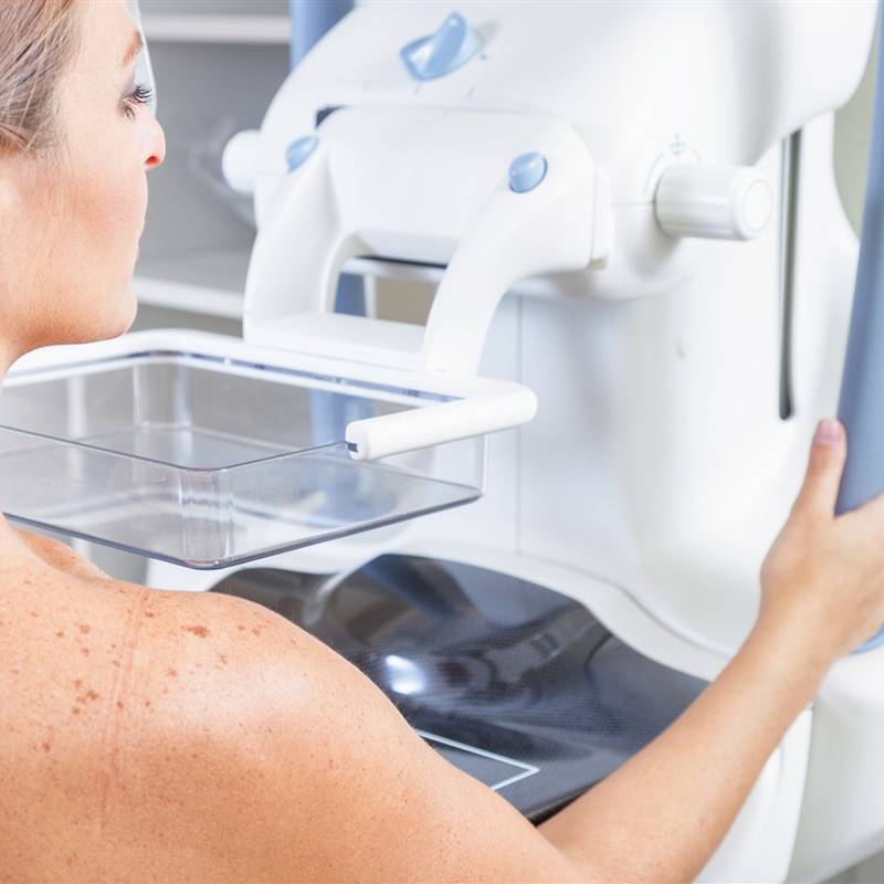 ¿Cada cuánto debes hacerte mamografías según tu riesgo de cáncer de mama?