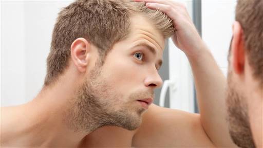 Injerto capilar: cómo se hace y cuáles son los efectos secundarios de un trasplante de pelo