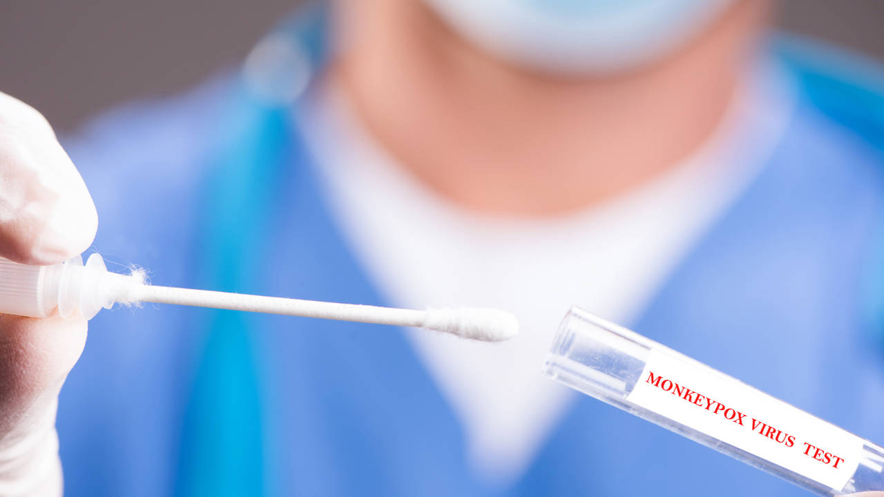 Los médicos alertan de una forma muy mortal de viruela del mono, rebautizado como mpox