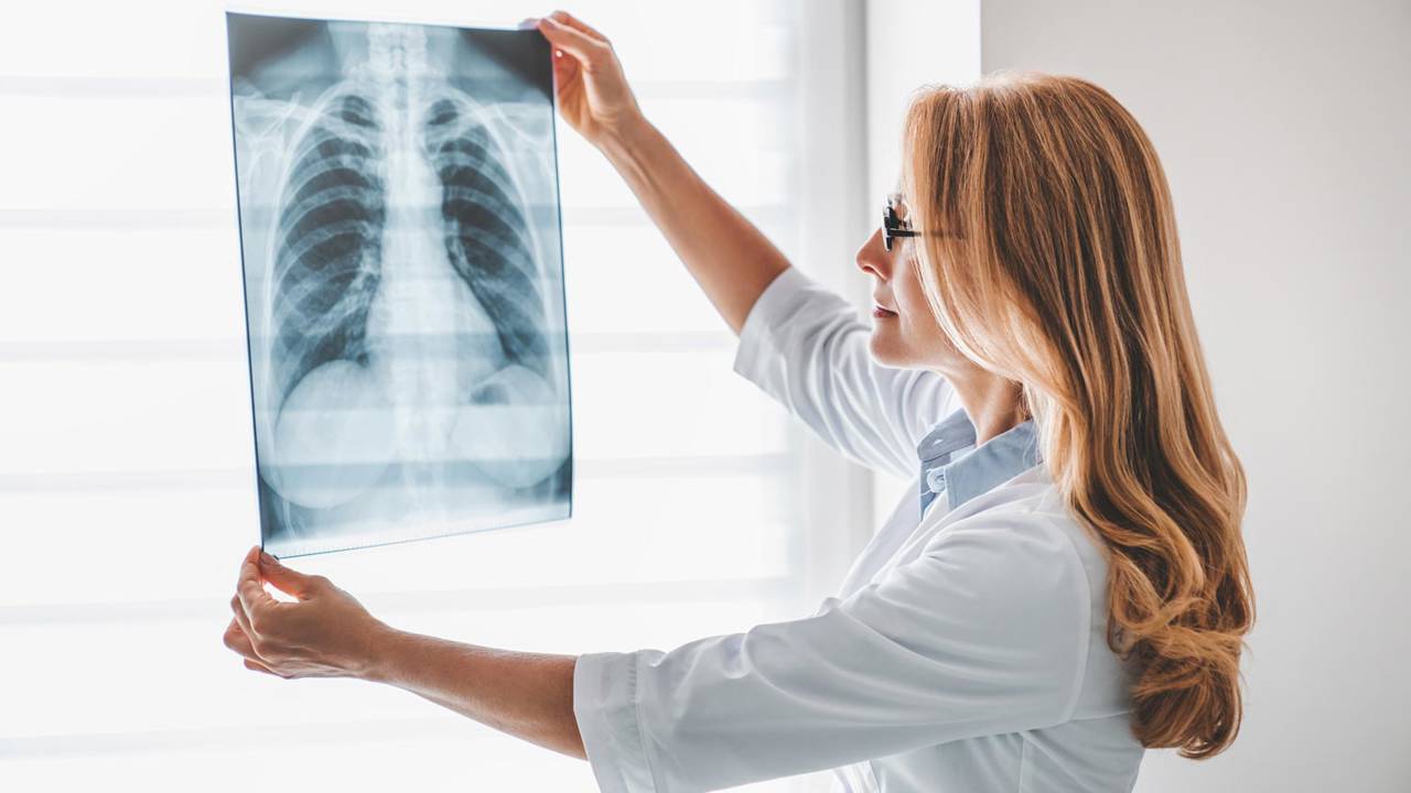 Radiografías: ¿qué riesgos tienen y cuántas te pueden hacer?