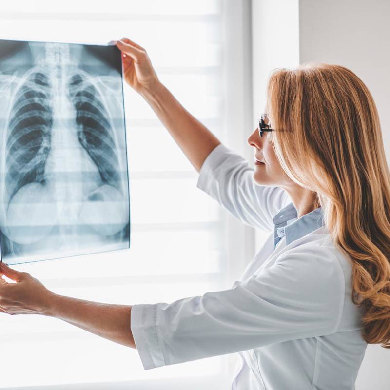¿Tienen algún riesgo las radiografías?