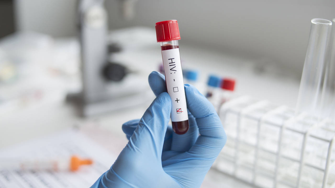 Se confirma un cuarto caso en el mundo de curación del VIH después de un trasplante de células madre