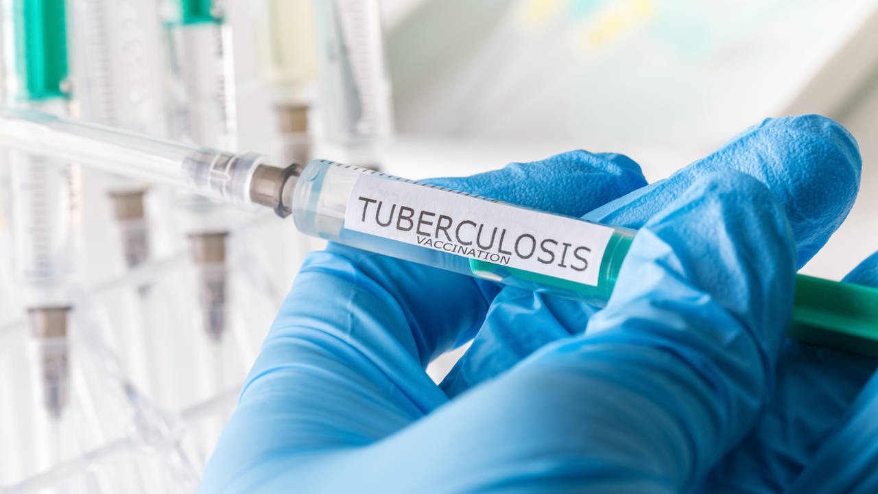 iStock tuberculosis(1)