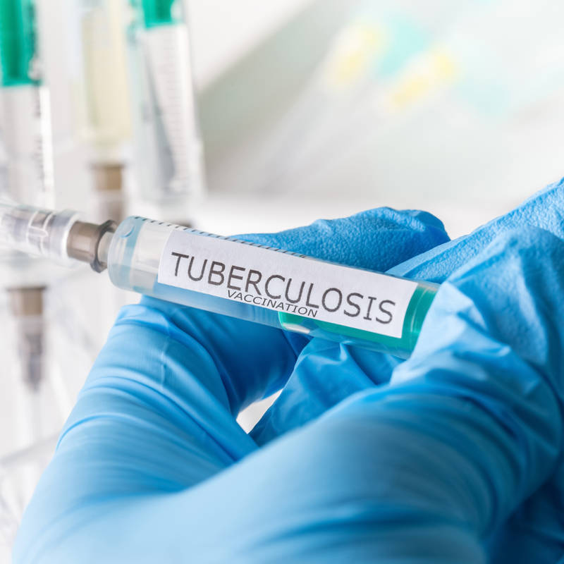 iStock tuberculosis(1)