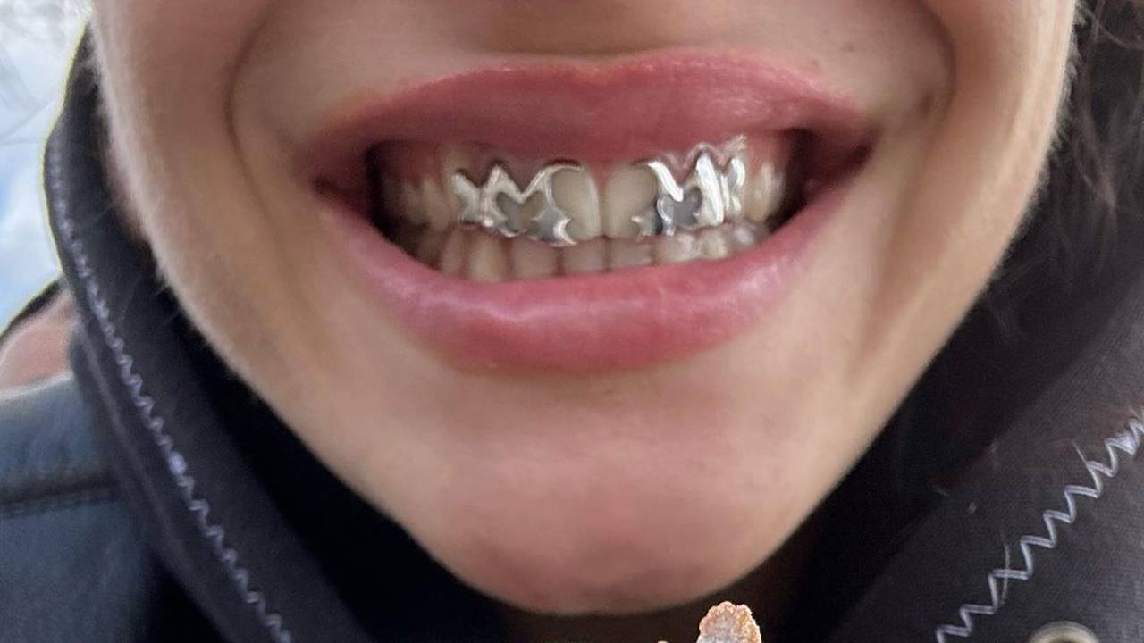 Grillz: las “peligrosas” fundas dentales de Rosalía que pueden dañar gravemente los dientes