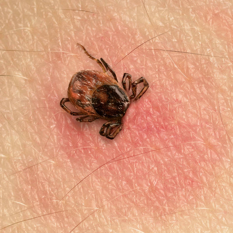 PICADURA GARRAPATA