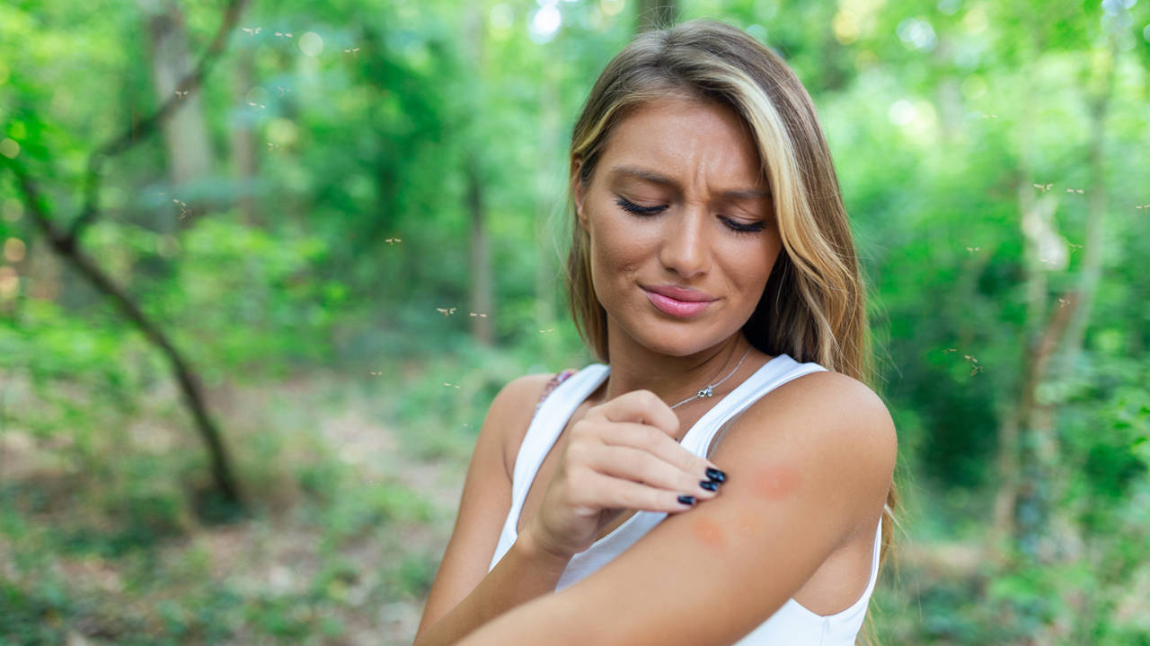 Cómo usar albahaca para aliviar rápidamente las picaduras de mosquito