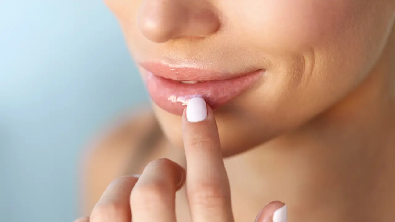 Remedios para curar un herpes labial más rápido