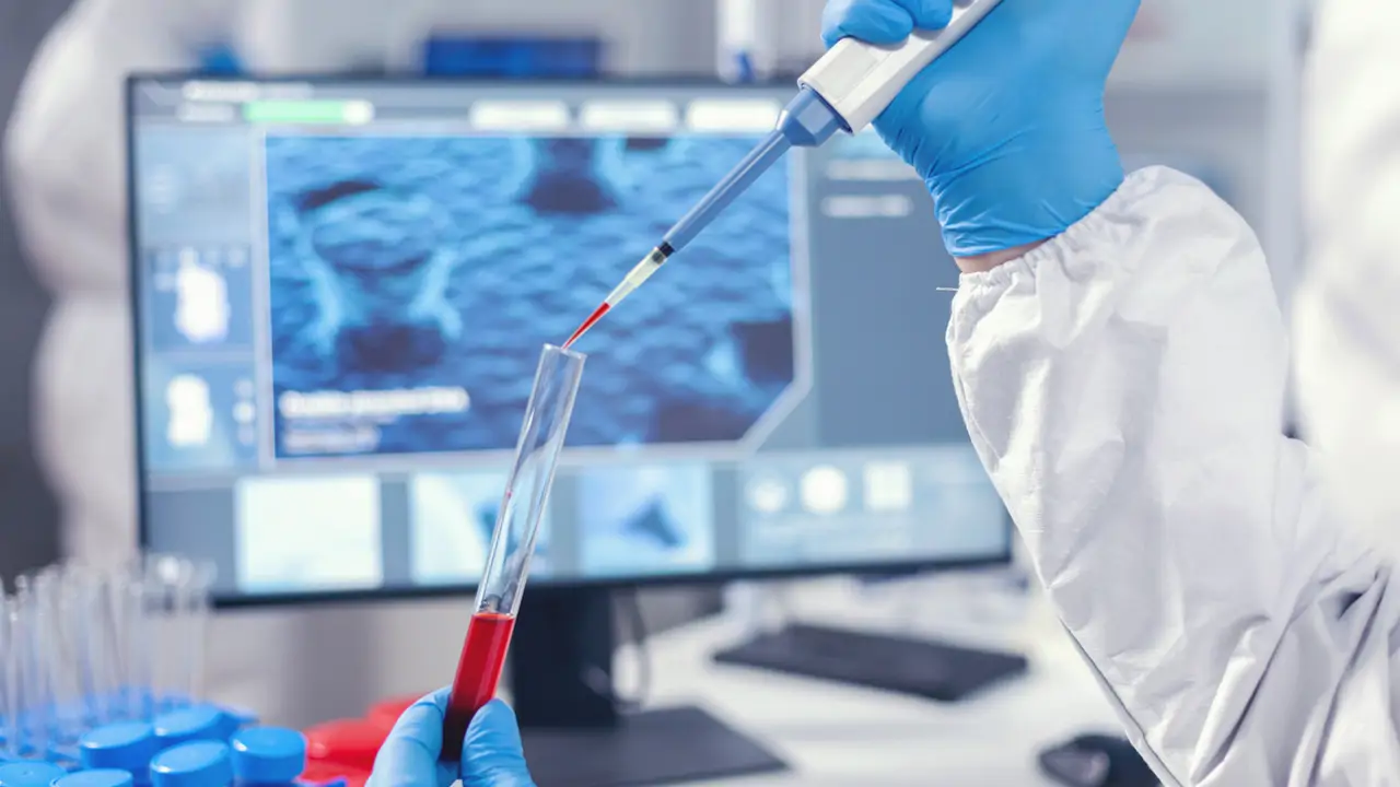 laboratorio de sangre
