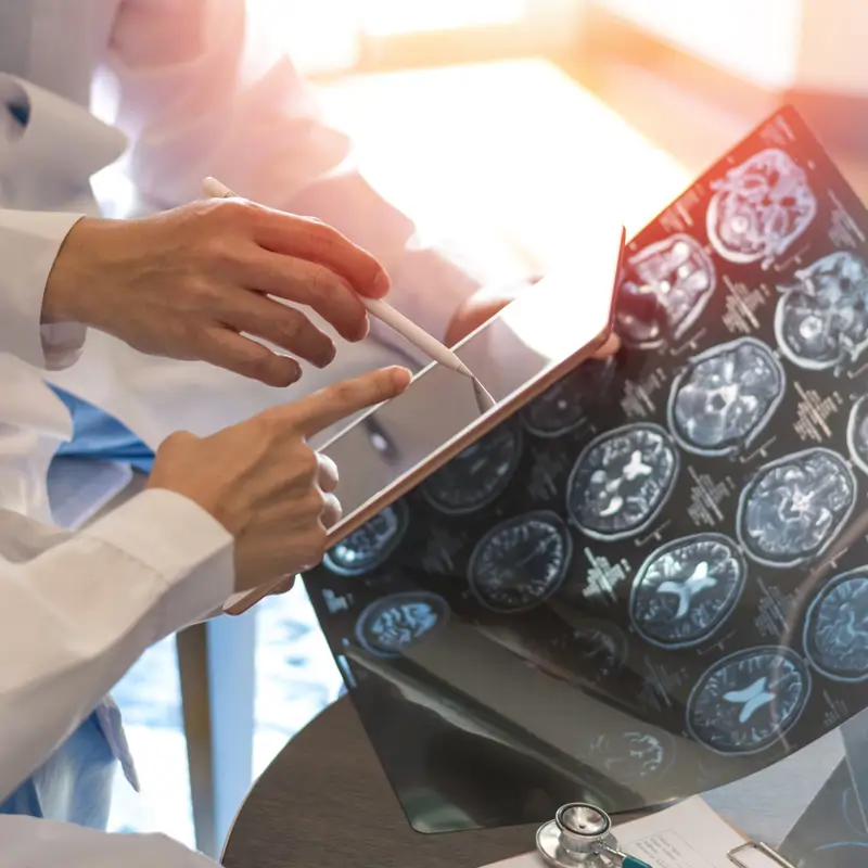 Los neurólogos recuerdan que cada cinco minutos se diagnostica un nuevo caso de esclerosis múltiple: “La detección precoz es fundamental”