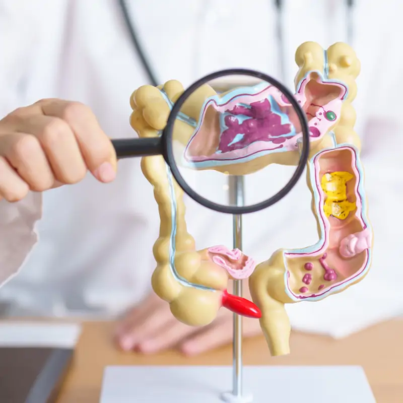 Una combinación de medicamentos logra duplicar la supervivencia en el cáncer de colon más agresivo