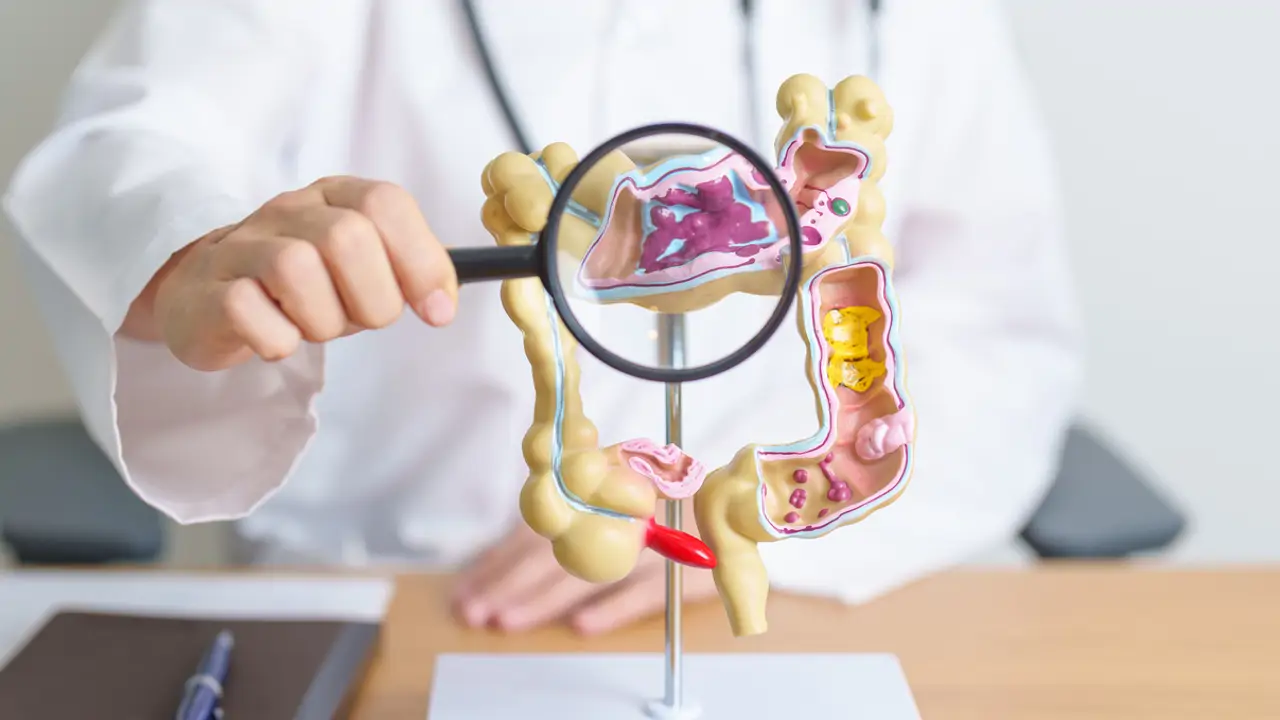 Una combinación de medicamentos logra duplicar la supervivencia en el cáncer de colon más agresivo