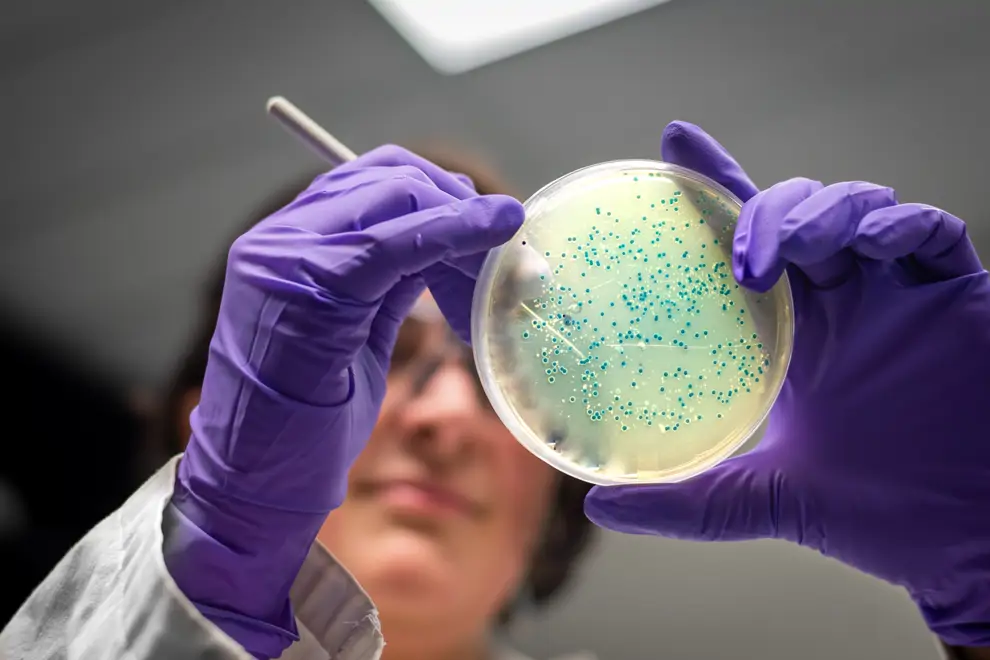 Microbiota. Examen de placa de cultivo bacteriano realizado por una investigadora en laboratorio de microbiología