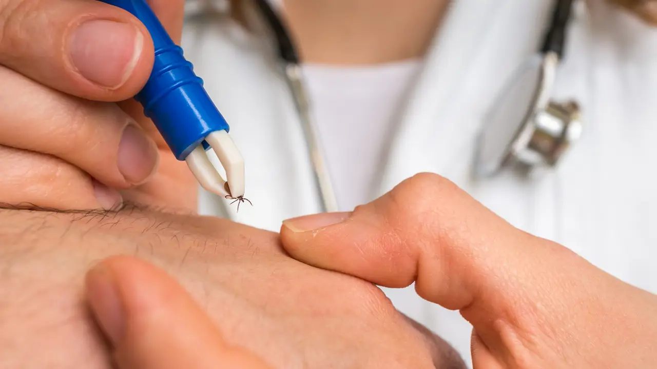 Alerta sanitaria en España por aumento de garrapatas: por qué preocupa y cómo protegerse