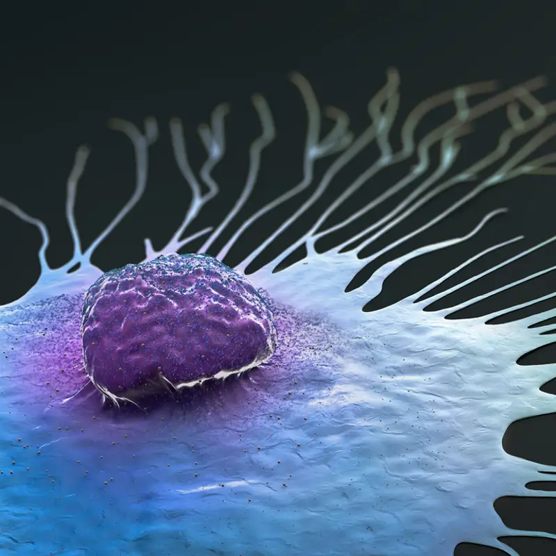Científicos españoles descubren una manera de frenar la metástasis del cáncer de mama