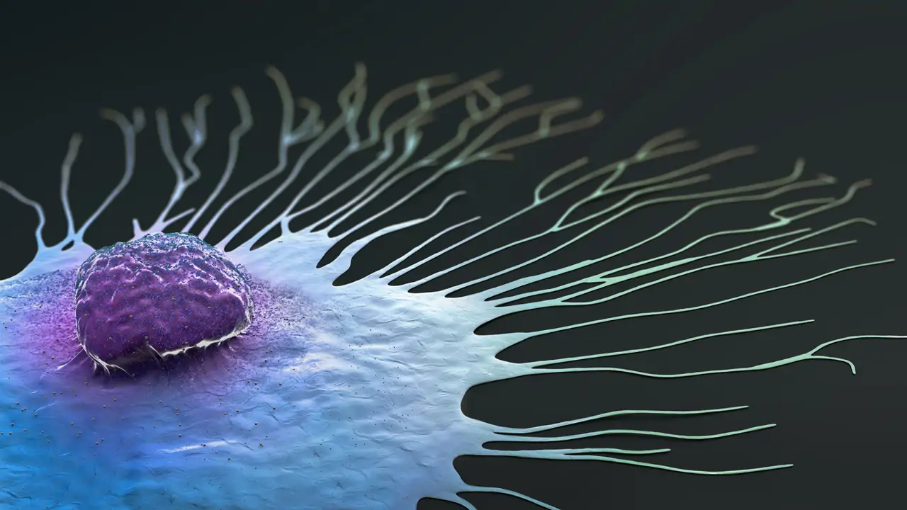 Científicos españoles descubren una manera de frenar la metástasis del cáncer de mama